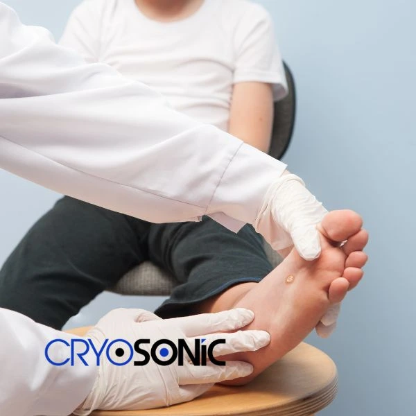 Are you looking for fast effective wart removal Contact us today Windsor