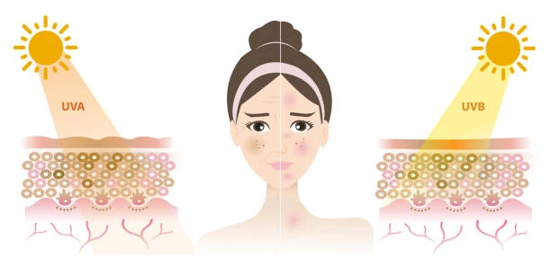 Understanding Sun Damage Windsor : How Do UV Rays Cause Changes in the Skin? Windsor